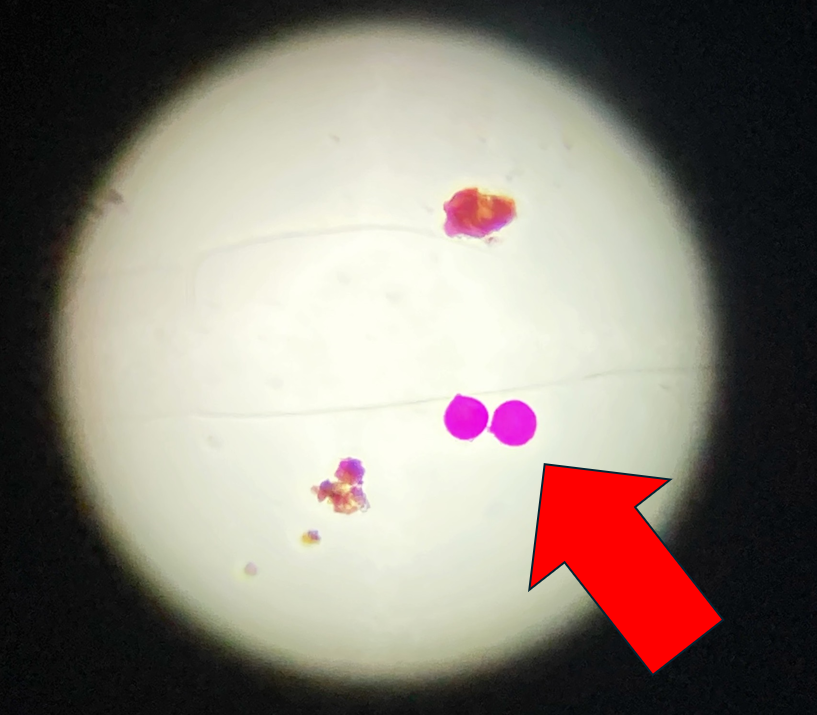 2月13日に千代田区で観測されたスギ花粉（染色）