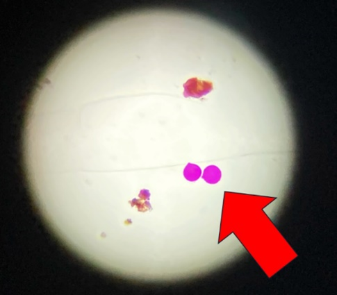 Stained cedar pollen